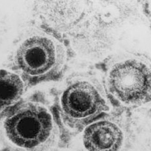 JUEVES 27 Abril 18.30h COLOQUIOS SOMICH Dra. Carola Otth «Herpes virus modula Funcion Neuronal»