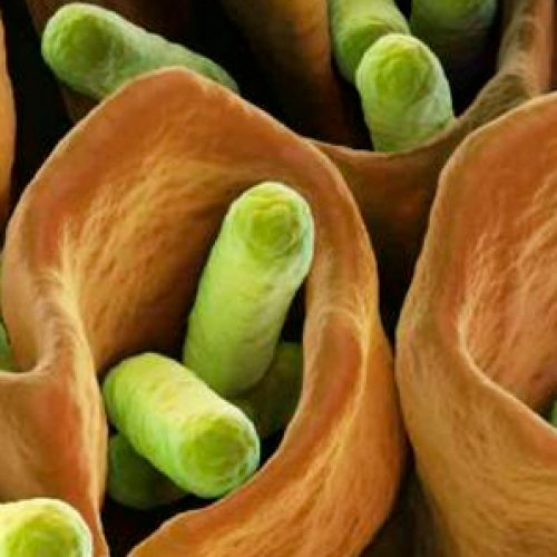 Curso de resistencia antimicrobiana: Enfrentamiento multidisciplinario para el futuro