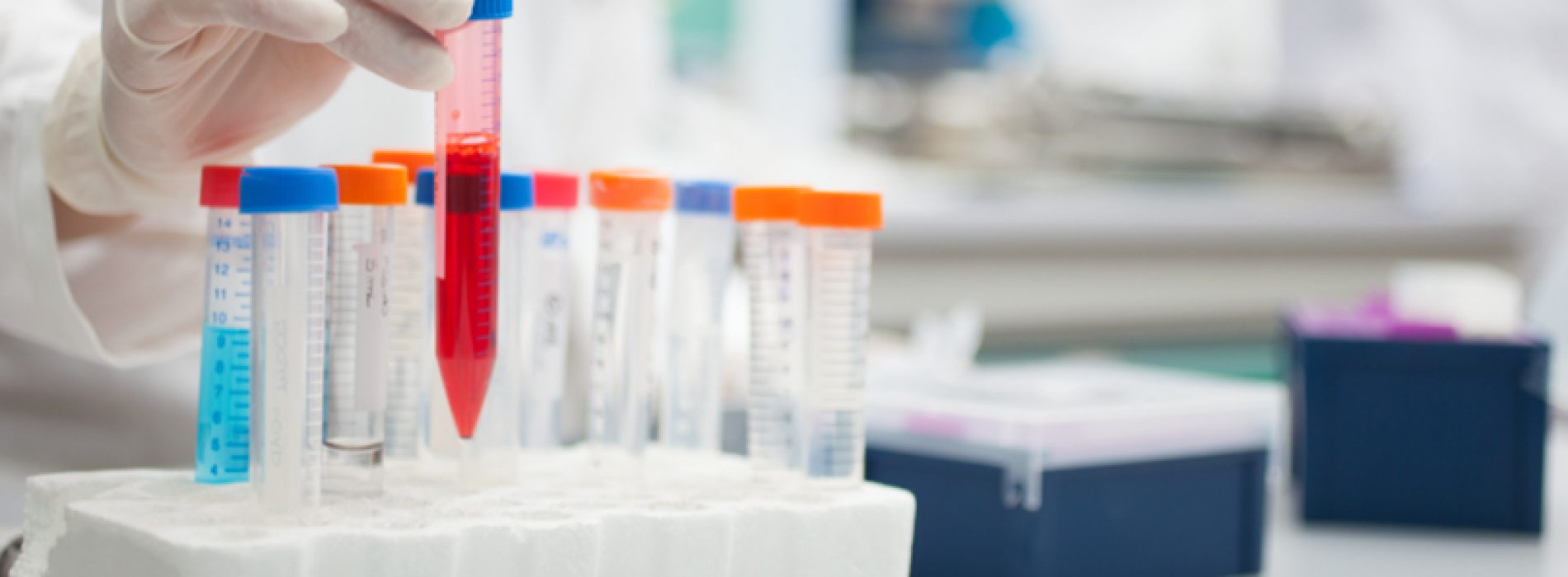 Doctorado Biotecnologia UTFSM-PUCV