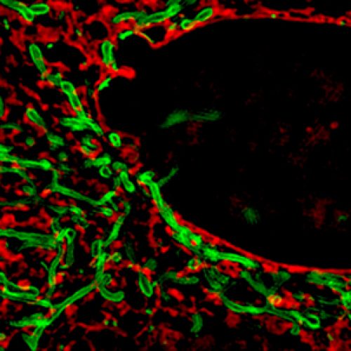 Program EMBO Workshop Membrane contact sites in health and disease – 21 – 25 September 2018 | Arosa, Switzerland