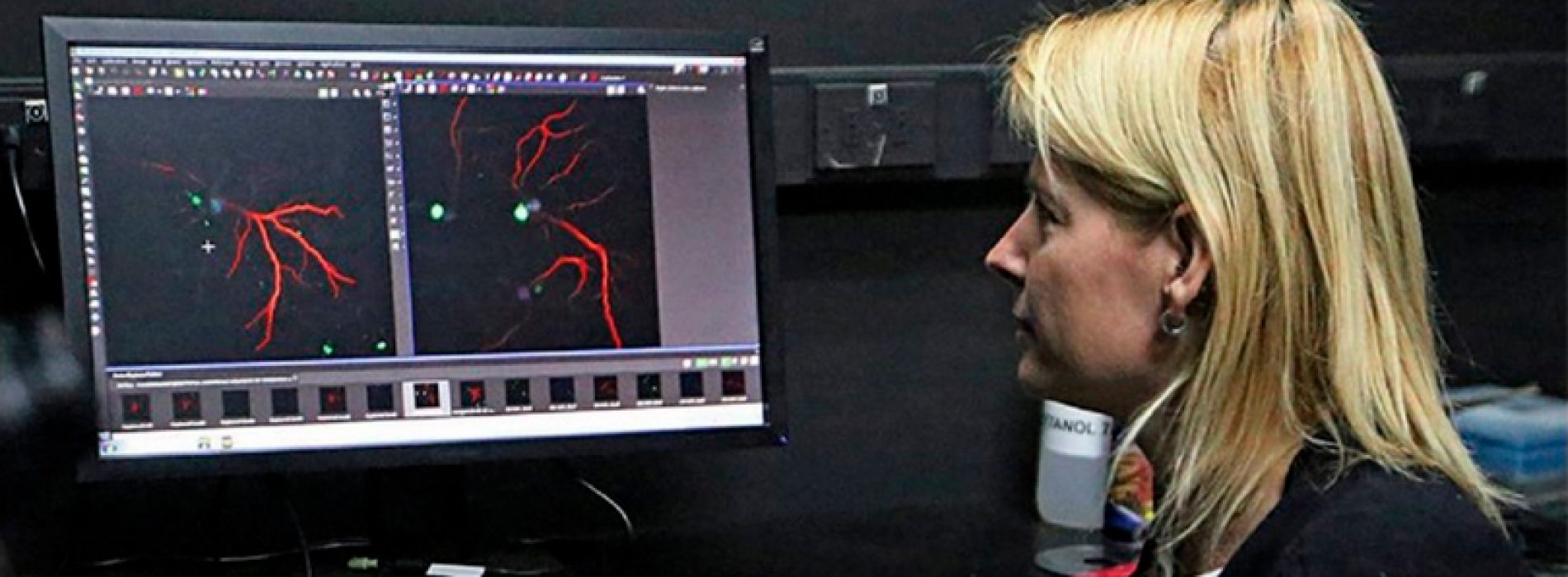 Logran que ratones con Alzheimer recuperen actividades cognitivas – Las Últimas Noticias