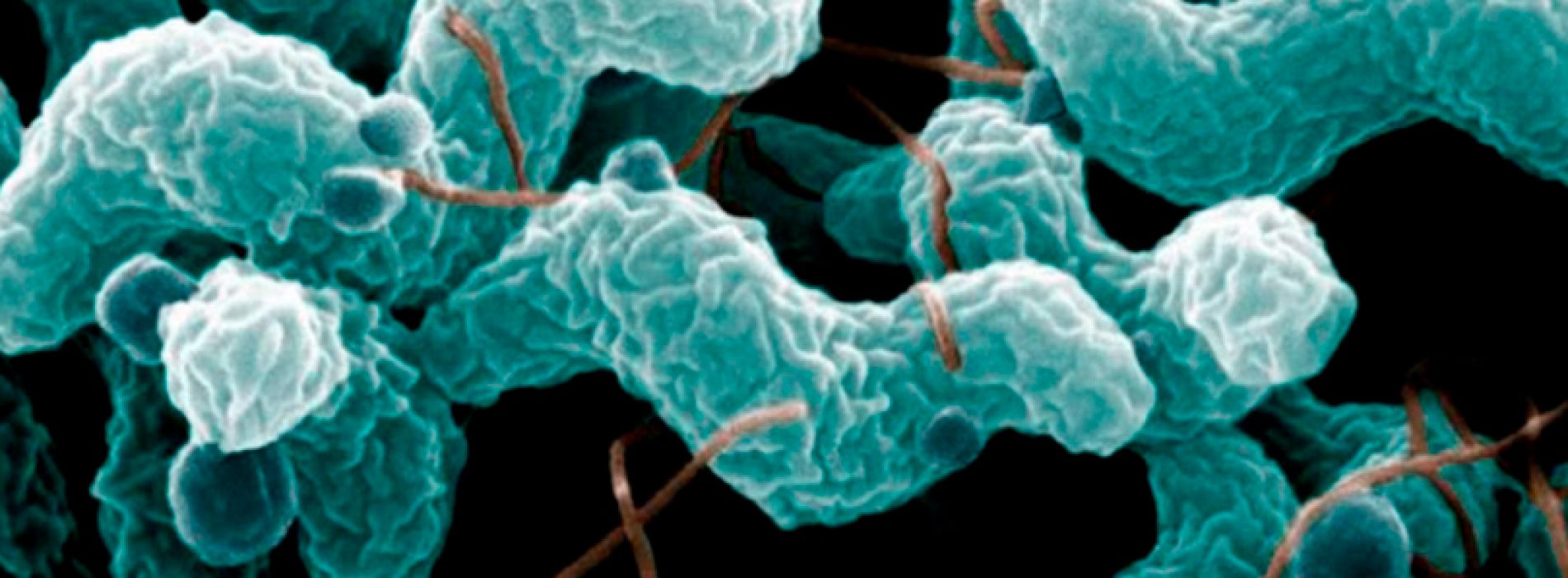 XVII Curso de Microbiología Clínica