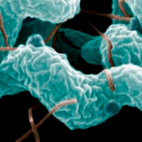 XVII Curso de Microbiología Clínica