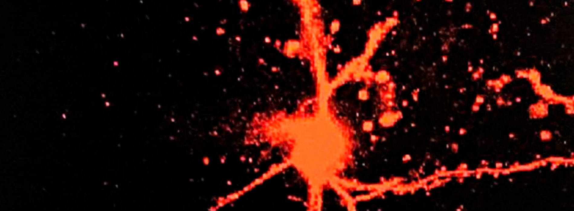 Amazing image of a group of neurons make synapses