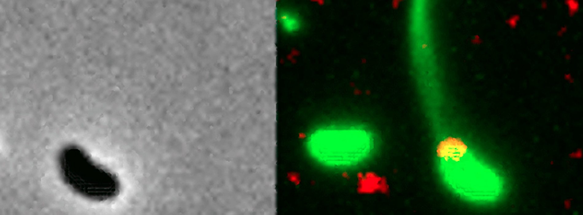 Recorded for the first time in video transformation of bacteria in a Superbug