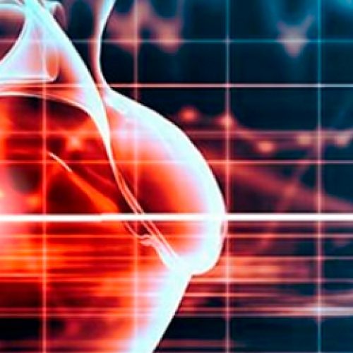 ACCDiS seminar: "Progress and challenges in ATRIAL FIBRILLATION" Dr. Ramón Corbalán