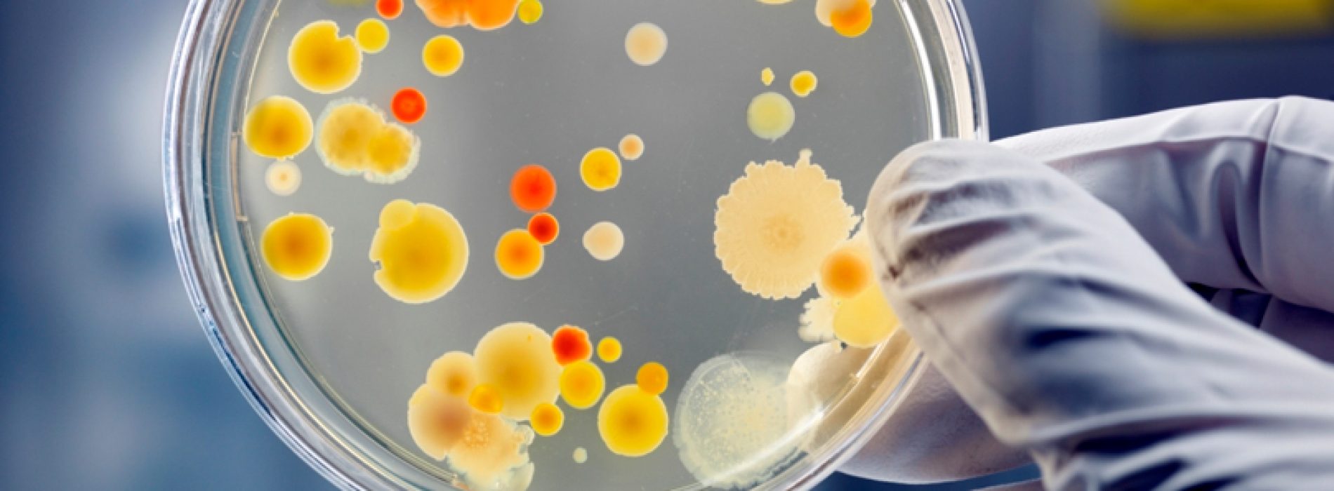 Master's degree in microbiology Society for Biochemistry and