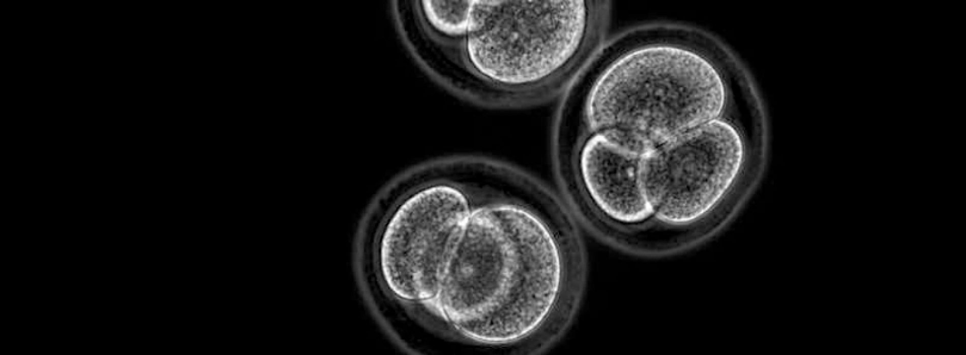 Embryo stem cells created from skin cells