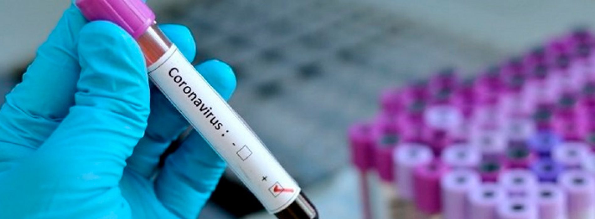 What distinguishes the new coronavirus? How do you study it? Will we have a vaccine soon? UNAB researcher answers these and other questions