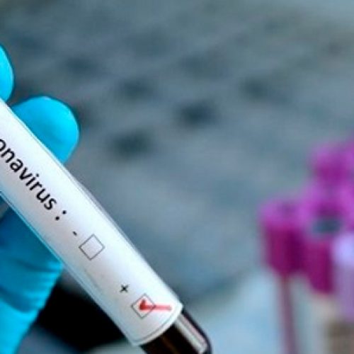 ¿Qué distingue al nuevo coronavirus? ¿Cómo se estudia? ¿Tendremos pronto una vacuna? Investigadora UNAB responde a éstas y otras interrogantes